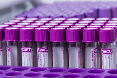 Клиника Реавиз