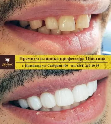 ДЕНТиК ЛЮКС