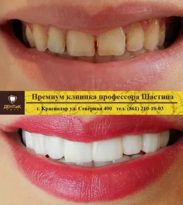 ДЕНТиК ЛЮКС