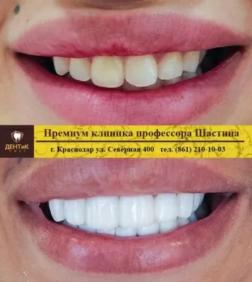 ДЕНТиК ЛЮКС