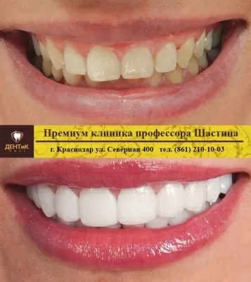 ДЕНТиК ЛЮКС