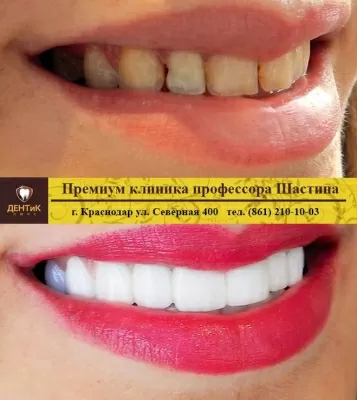 ДЕНТиК ЛЮКС