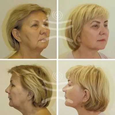 МедиЭстетик