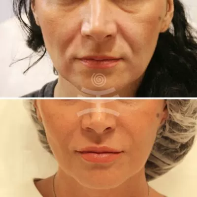 МедиЭстетик