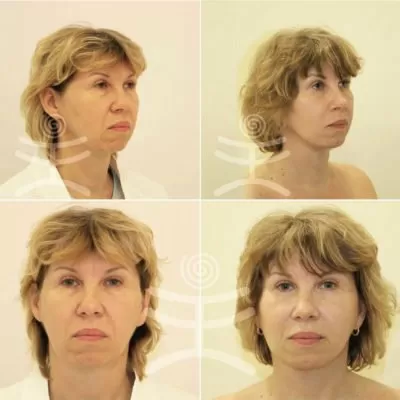 МедиЭстетик