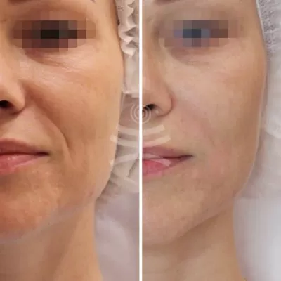 МедиЭстетик