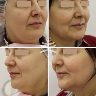 МедиЭстетик