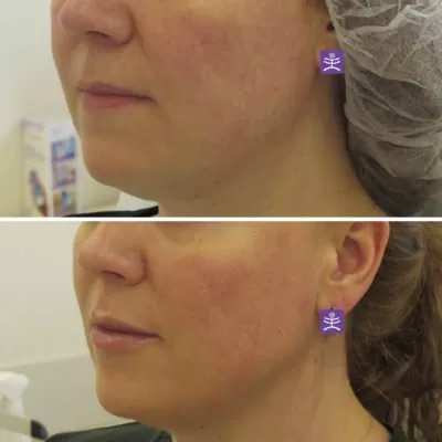 МедиЭстетик