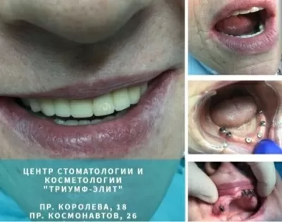 Триумф-Элит