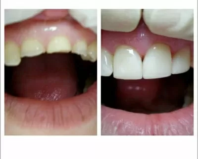 Триумф-Элит