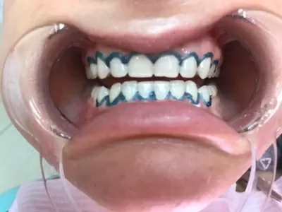 Триумф-Элит