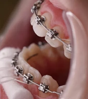 Мастер Дент