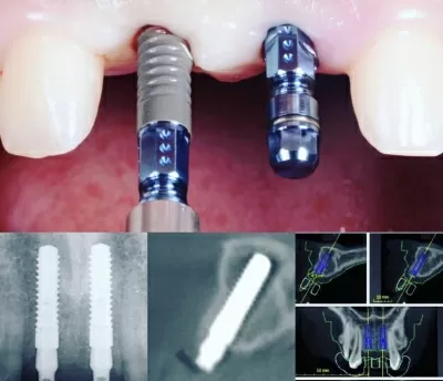 Мастер Дент