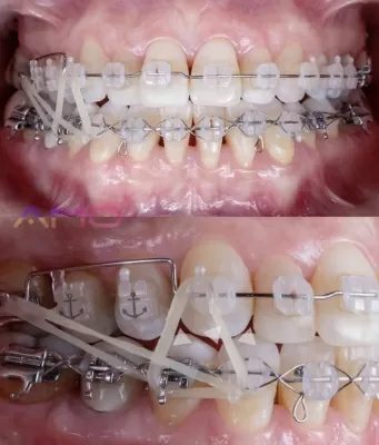 Мастер Дент