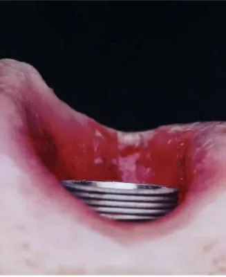 Мастер Дент