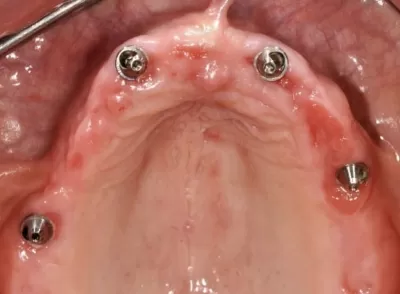 Мастер Дент