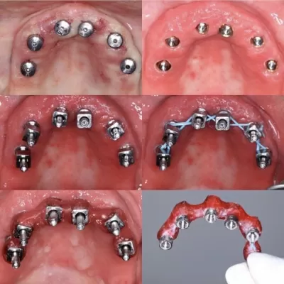 Мастер Дент