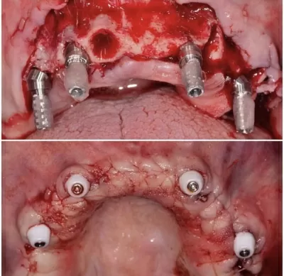 Мастер Дент