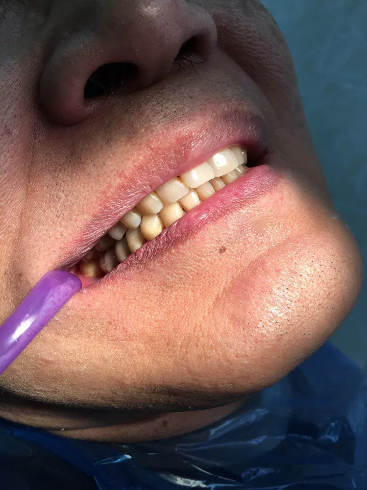 Белая жемчужина