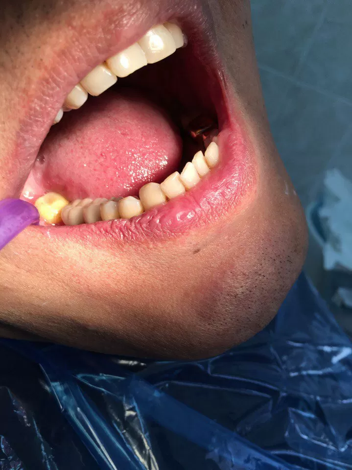 Белая жемчужина