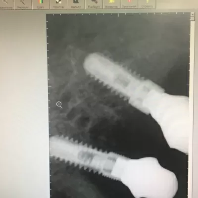 Белая жемчужина