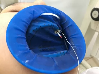 Белая жемчужина