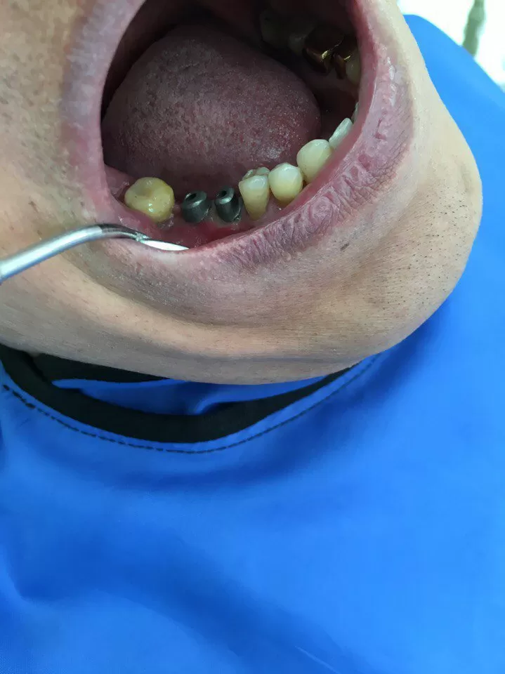 Белая жемчужина