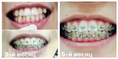 Белая жемчужина