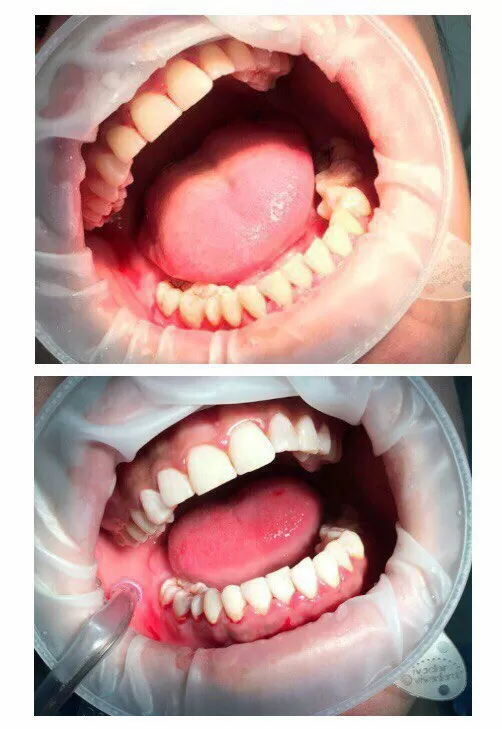 Белая жемчужина