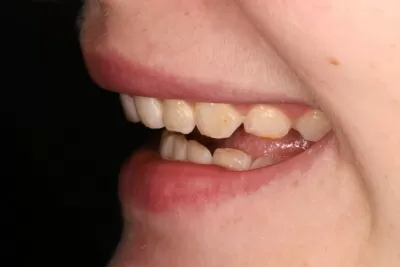 Стоматология Доктора Хачатуряна Best Smile Clinic