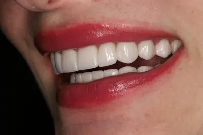 Стоматология Доктора Хачатуряна Best Smile Clinic