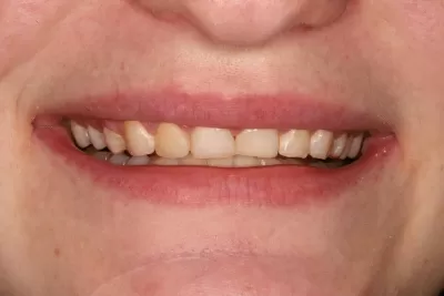 Стоматология Доктора Хачатуряна Best Smile Clinic