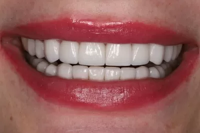 Стоматология Доктора Хачатуряна Best Smile Clinic