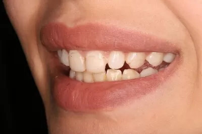 Стоматология Доктора Хачатуряна Best Smile Clinic
