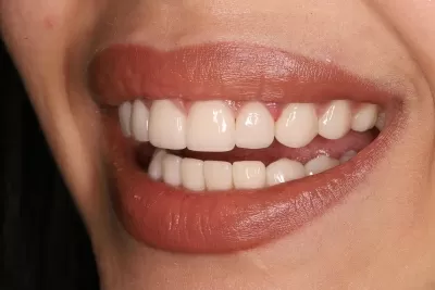 Стоматология Доктора Хачатуряна Best Smile Clinic