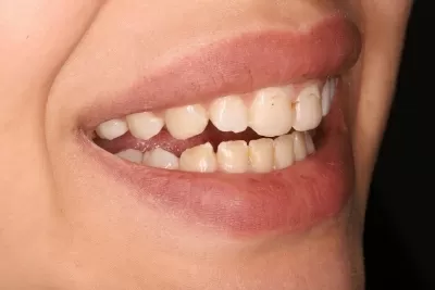 Стоматология Доктора Хачатуряна Best Smile Clinic