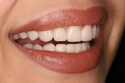 Стоматология Доктора Хачатуряна Best Smile Clinic