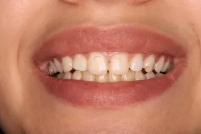 Стоматология Доктора Хачатуряна Best Smile Clinic