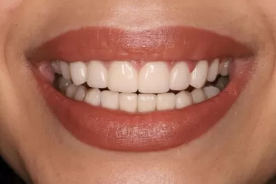 Стоматология Доктора Хачатуряна Best Smile Clinic