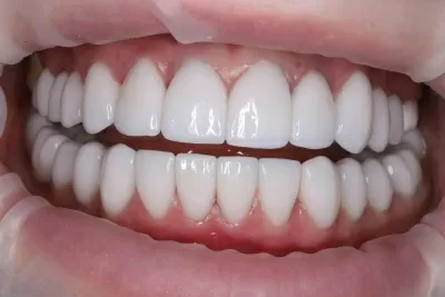 Стоматология Доктора Хачатуряна Best Smile Clinic