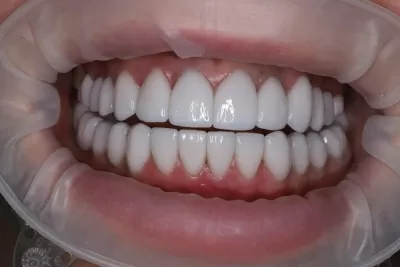 Стоматология Доктора Хачатуряна Best Smile Clinic