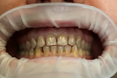 Страна улыбок