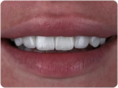 Авторская клиника эстетической стоматологии