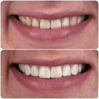 Авторская клиника эстетической стоматологии