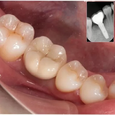 Авторская клиника эстетической стоматологии