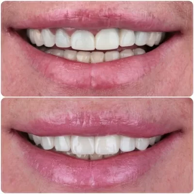 Студия Улыбок