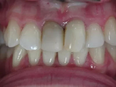 Вега Дентал