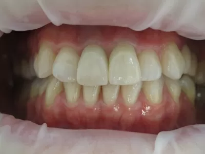 Вега Дентал