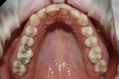 Вега Дентал