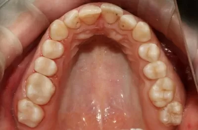 Вега Дентал